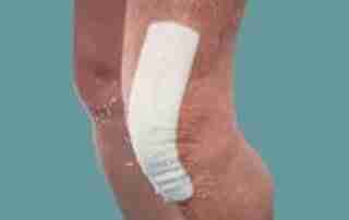 The Art of Wound Management - 5 ways to achieve better outcomes