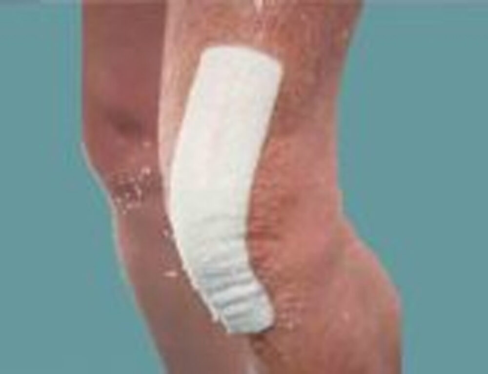 Antibiotics After Joint Replacement Orthopedic Surgery