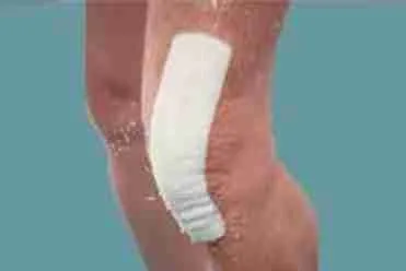 The Art of Wound Management – 5 ways to achieve better outcomes The Art of Wound Management - 5 ways to achieve better outcomes