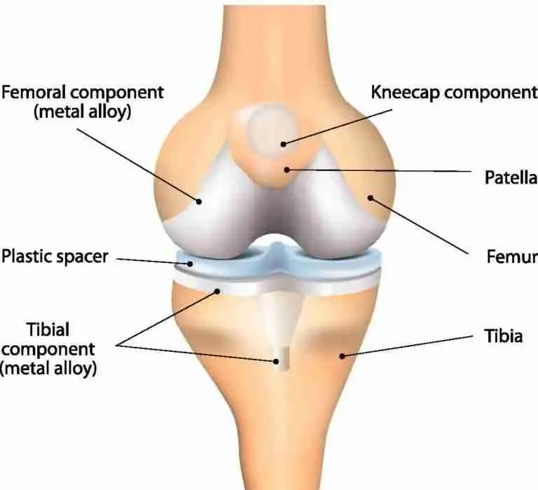 Total Knee Replacement