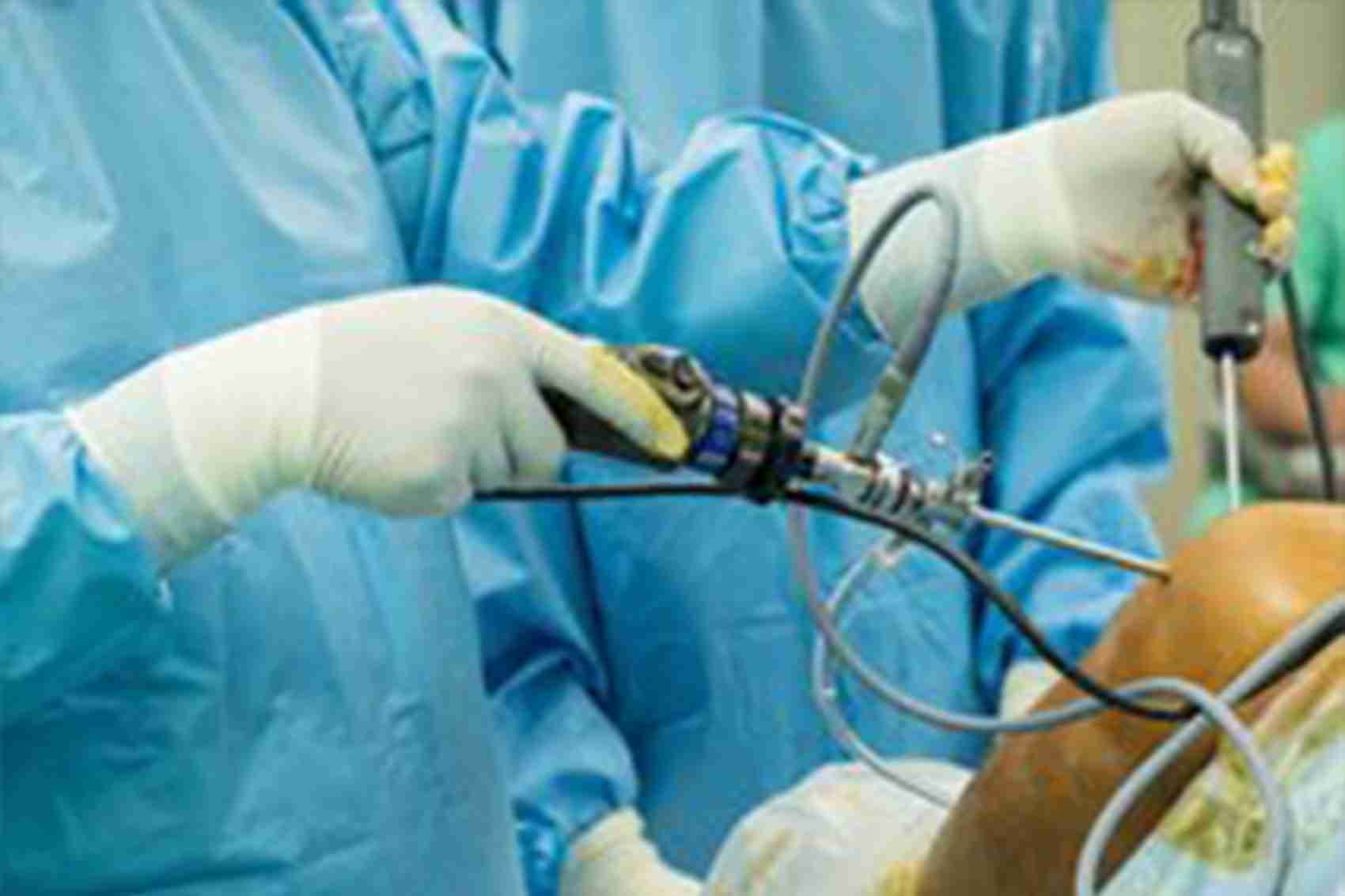 Knee Arthroscopy Knee Arthroscopy