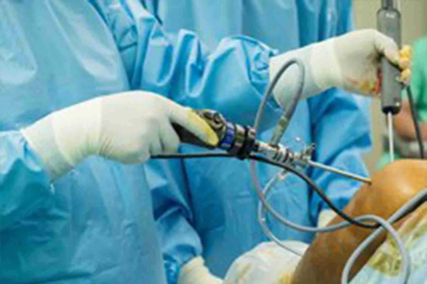 Knee Arthroscopy Knee Arthroscopy