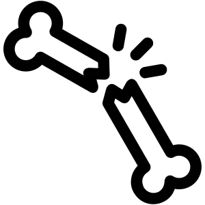 Knee Pain 32 Fracture