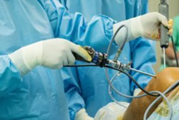 Knee Arthroscopy