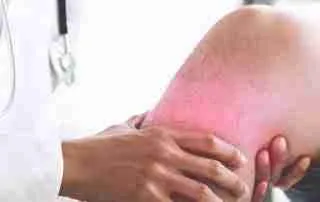 Rapid Recovery Joint Replacement: Faster Recovery after Surgery 14 pi-3-2