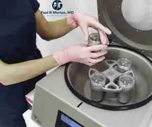 Platelet Rich Plasma (PRP) Knee Injections - Treat Arthritis, Inflammation & Joint Pain 14 PRP Centrifuge