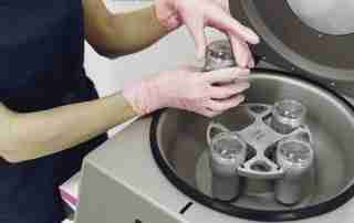 PRP Centrifuge