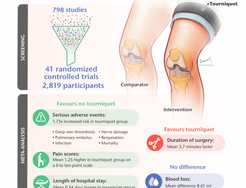 無止血帶膝關節置換術 – 減少疼痛,加快恢復速度