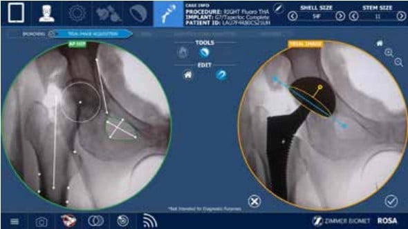 Final Implant Final Implant