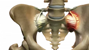 SI Joint Pain 2