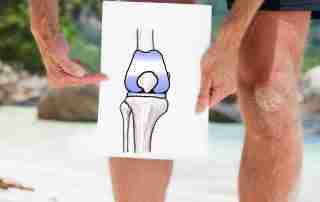 Am I Too Young For a Knee Replacement