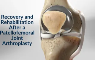 Patellofemoral Joint Arthroplasty 11 download 3