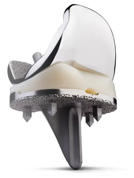 Zimmer Cementless Knee Zimmer Cementless Knee