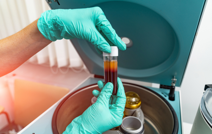 PRP Centrifuge e1707778157174