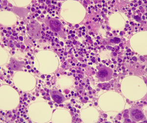 Bone Marrow Cells
