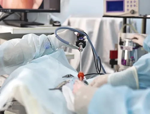 The Role of PRP in Meniscus Repair Surgery in 2025