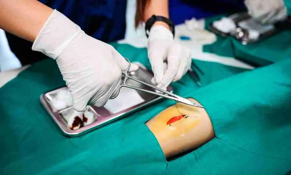 Understanding Limb Lengthening