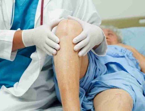Uncemented Knee Replacement: What Patients Should Know