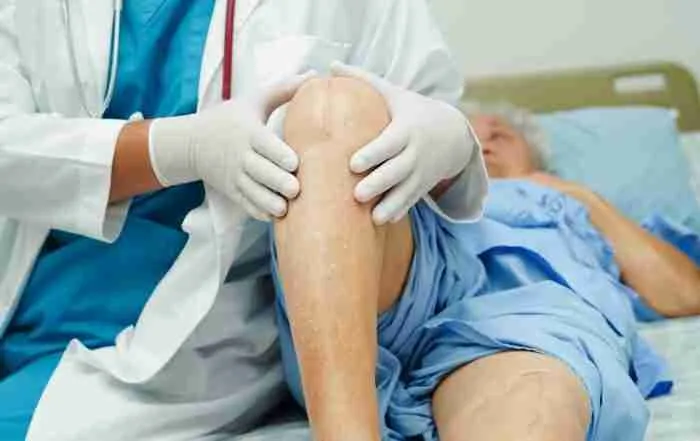 Partial Knee Replacement Surgery 57 Uncemented Knee Replacement: What Patients Should Know