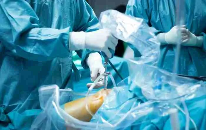 Partial Knee Replacement Surgery 55 Personalized Alignment In Knee Replacement Surgery